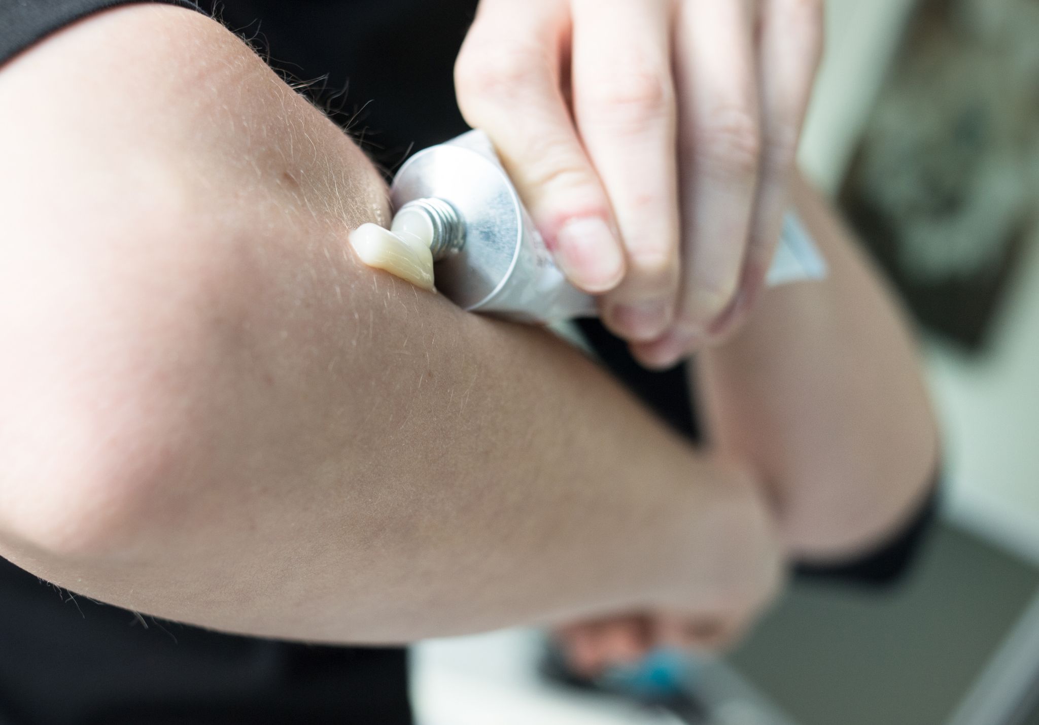 Fünf Schmerzsalben schneiden bei der Zeitschrift «Öko-Test» sehr gut ab - drei setzen auf Ibuprofen, jeweils eine auf Piroxicam und Felbinac.