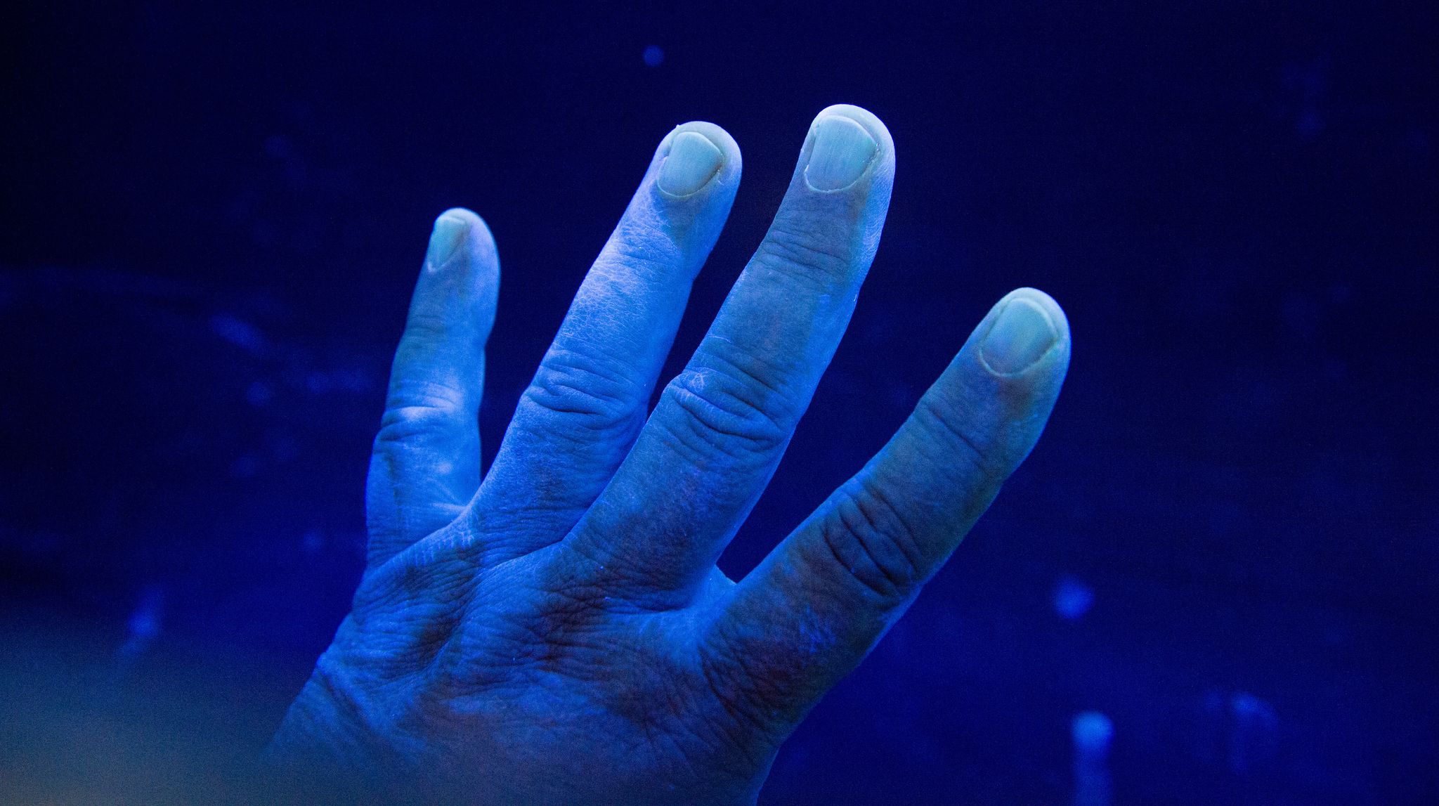 Ist da was? Weil Keime unsichtbar sind, ist eine gewisse Unsicherheit nachvollziehbar.