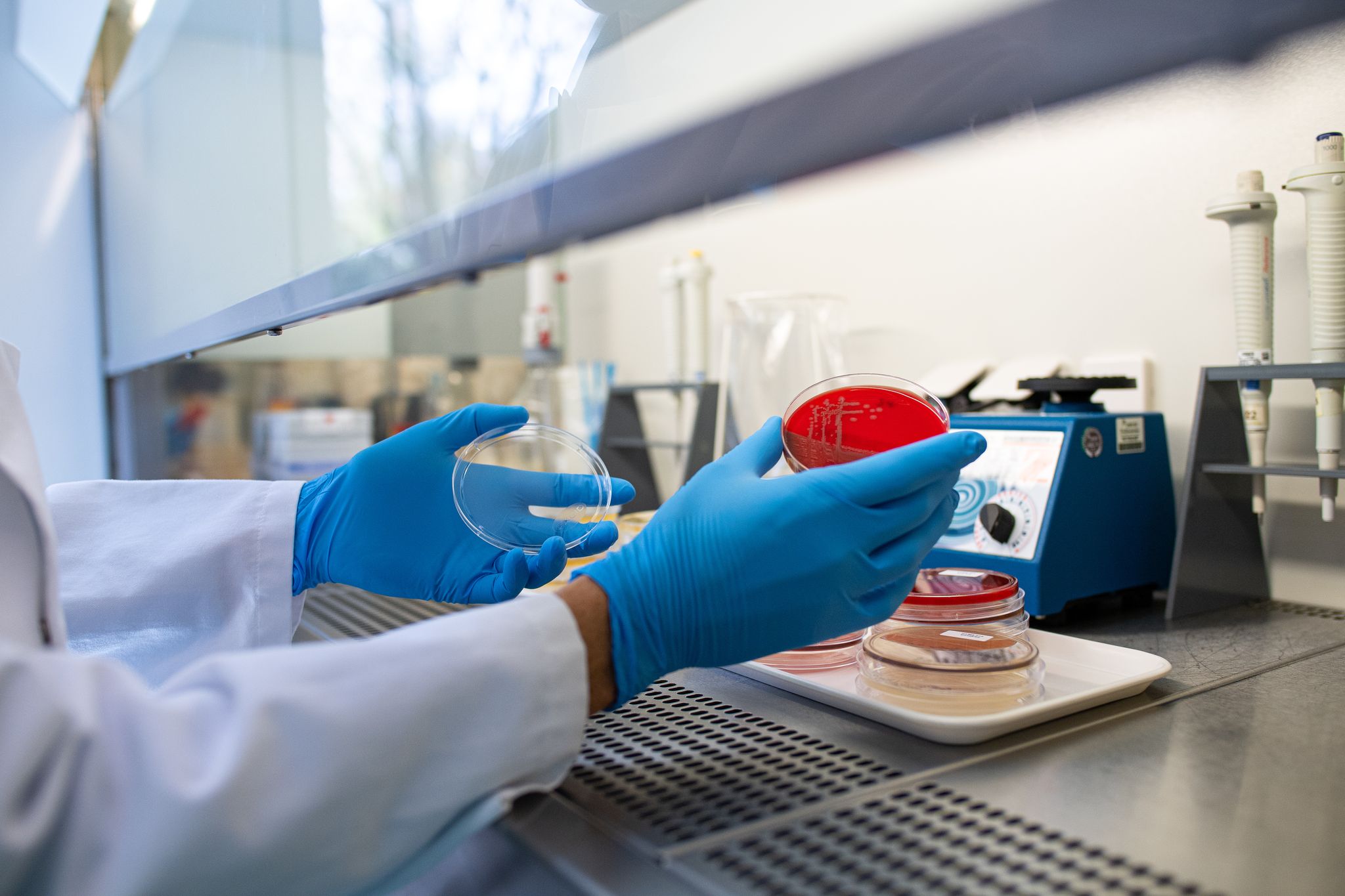 Die Zahl der registrierten Ehec-Infektionen in Mecklenburg-Vorpommern hat sich auf 17 erhöht. (Illustration)