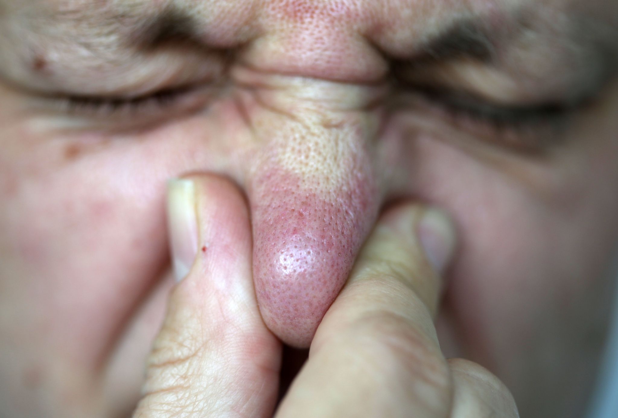 Ein Flug in der Economy-Klasse kann neben einem Viel-Pupser zur Herausforderung werden (Archivbild)