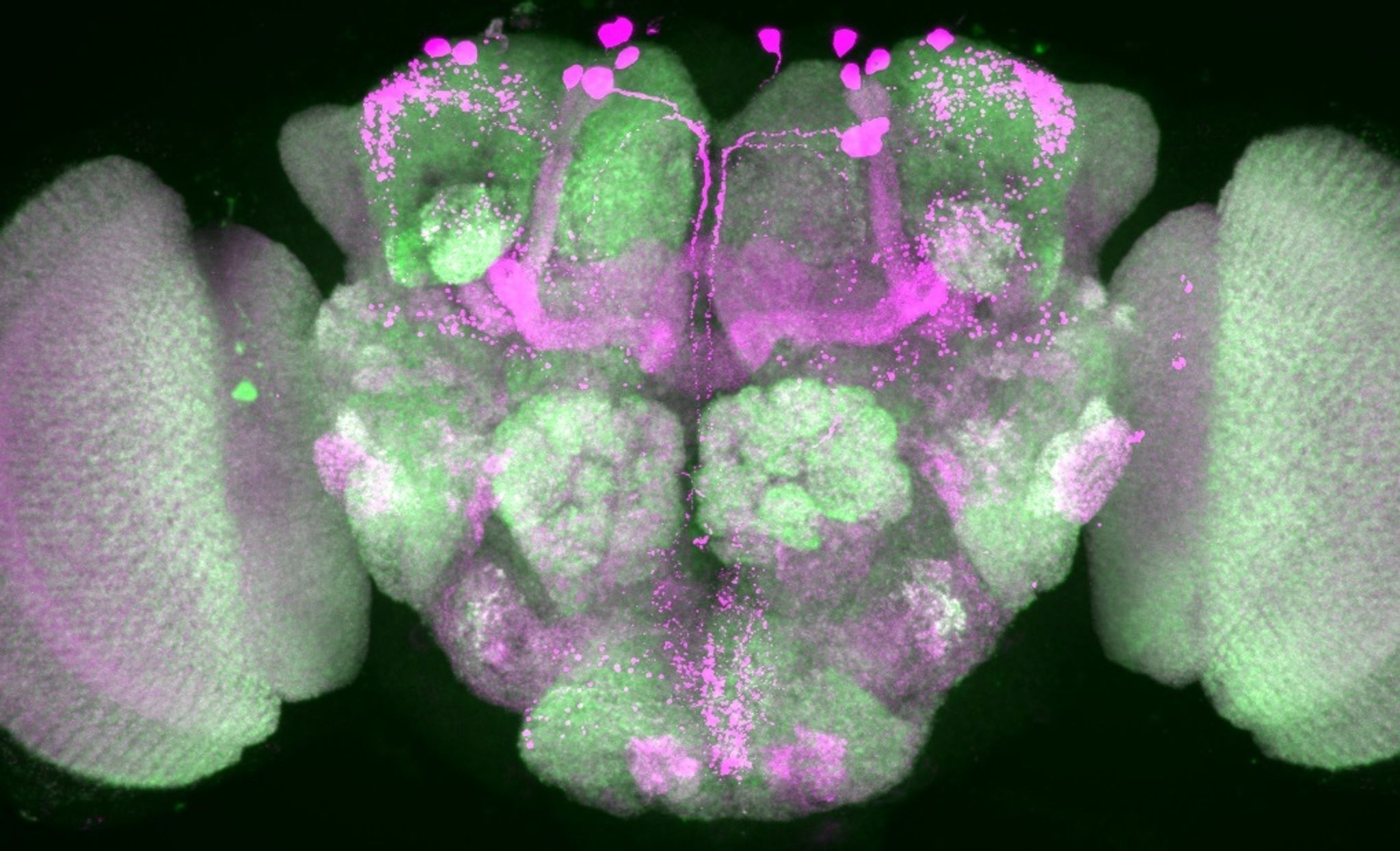 Nervenzellen im Gehirn einer Taufliege wurden durch Forscher pink eingefärbt, Nervenzellenverbindungen sind grün dargestellt.
