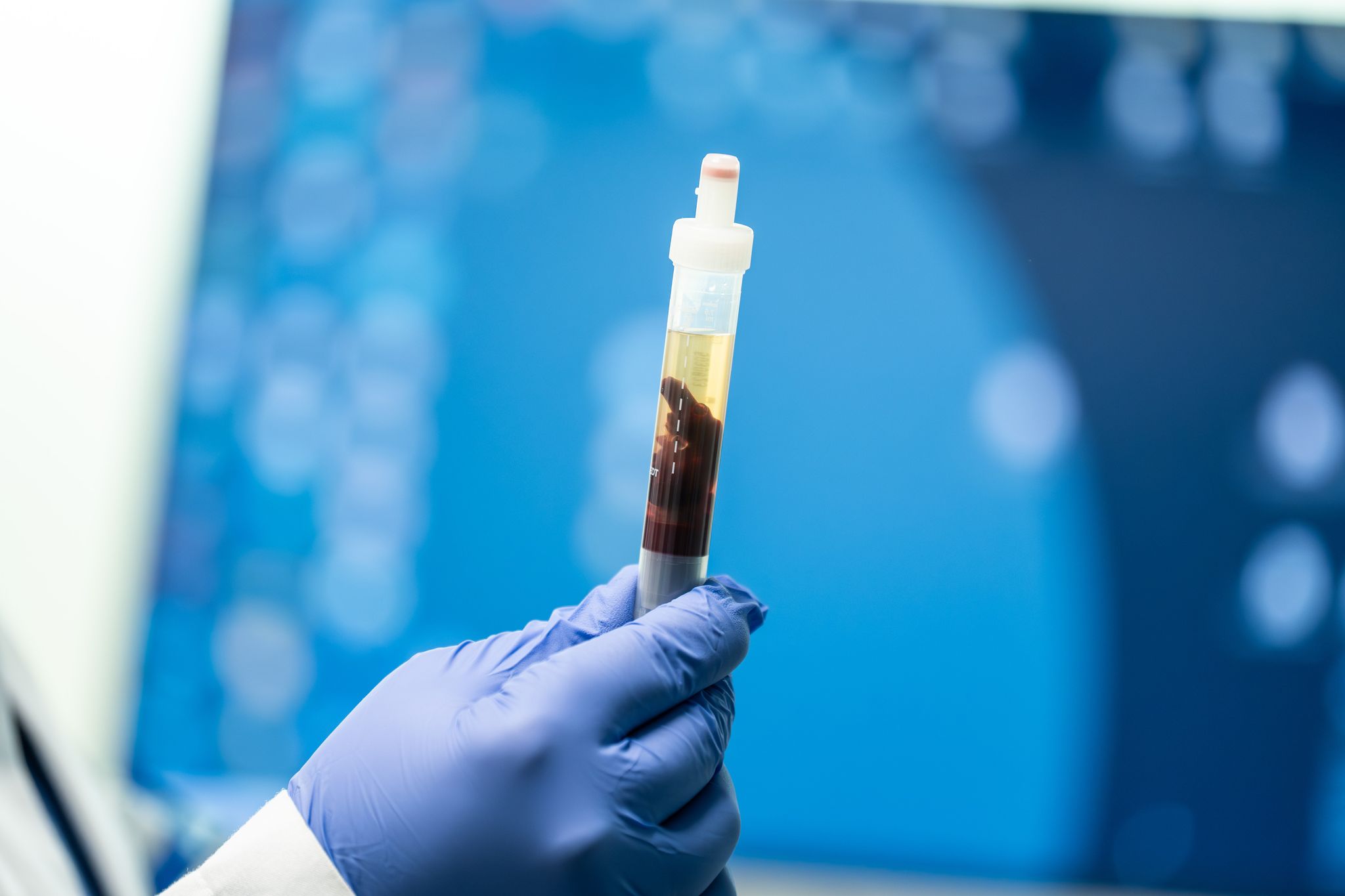 In Kalifornien konnte eine Pest-Infektion nachgewiesen werden