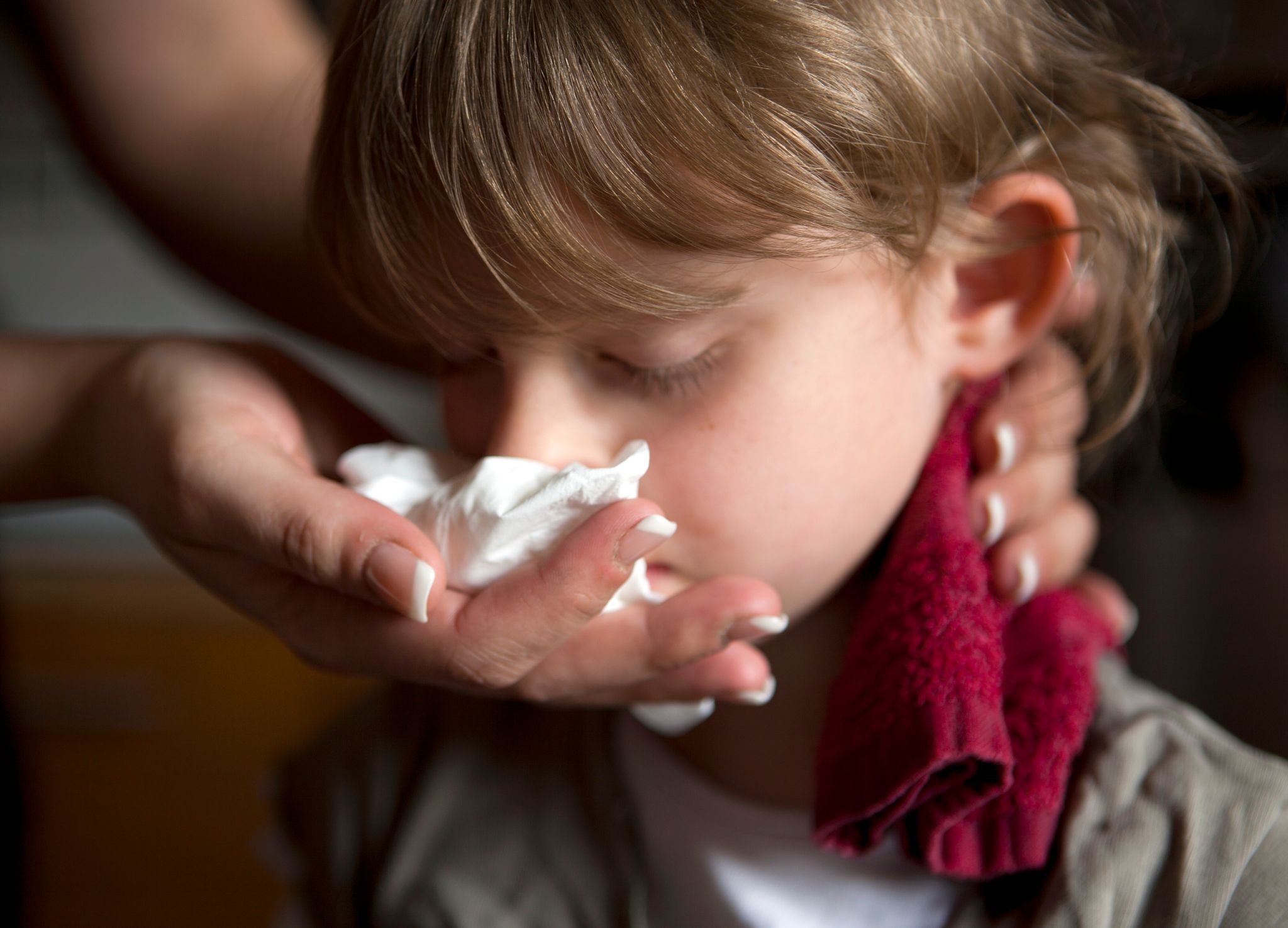 Wenn die Nase blutet, hilft Kühlung im Nacken, die Blutung zu stoppen.