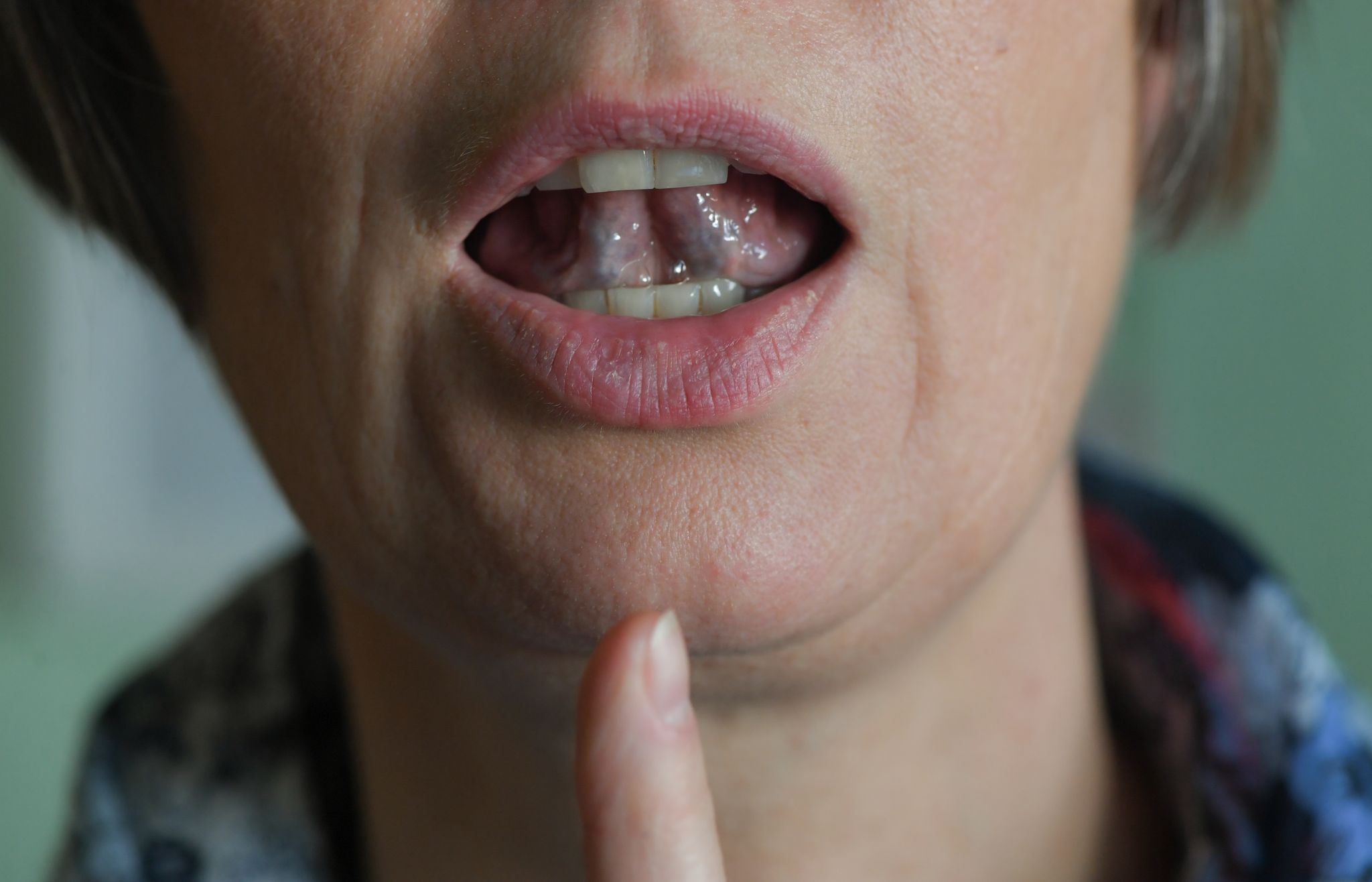 Stotternde Menschen können mit Hilfe von regelmäßigen Sprechübungen ihren Redefluss verbessern. (Symbolbild)